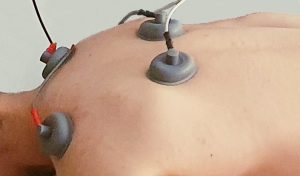 Elektroterapia – kombinovaný elektroterapeutický prístroj GYMNA – GUIDANCE®